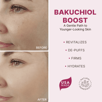 Before and after comparison of skin with Bakuchiol Boost product, highlighting revitalization, de-puffing, firming, and hydrating effects.