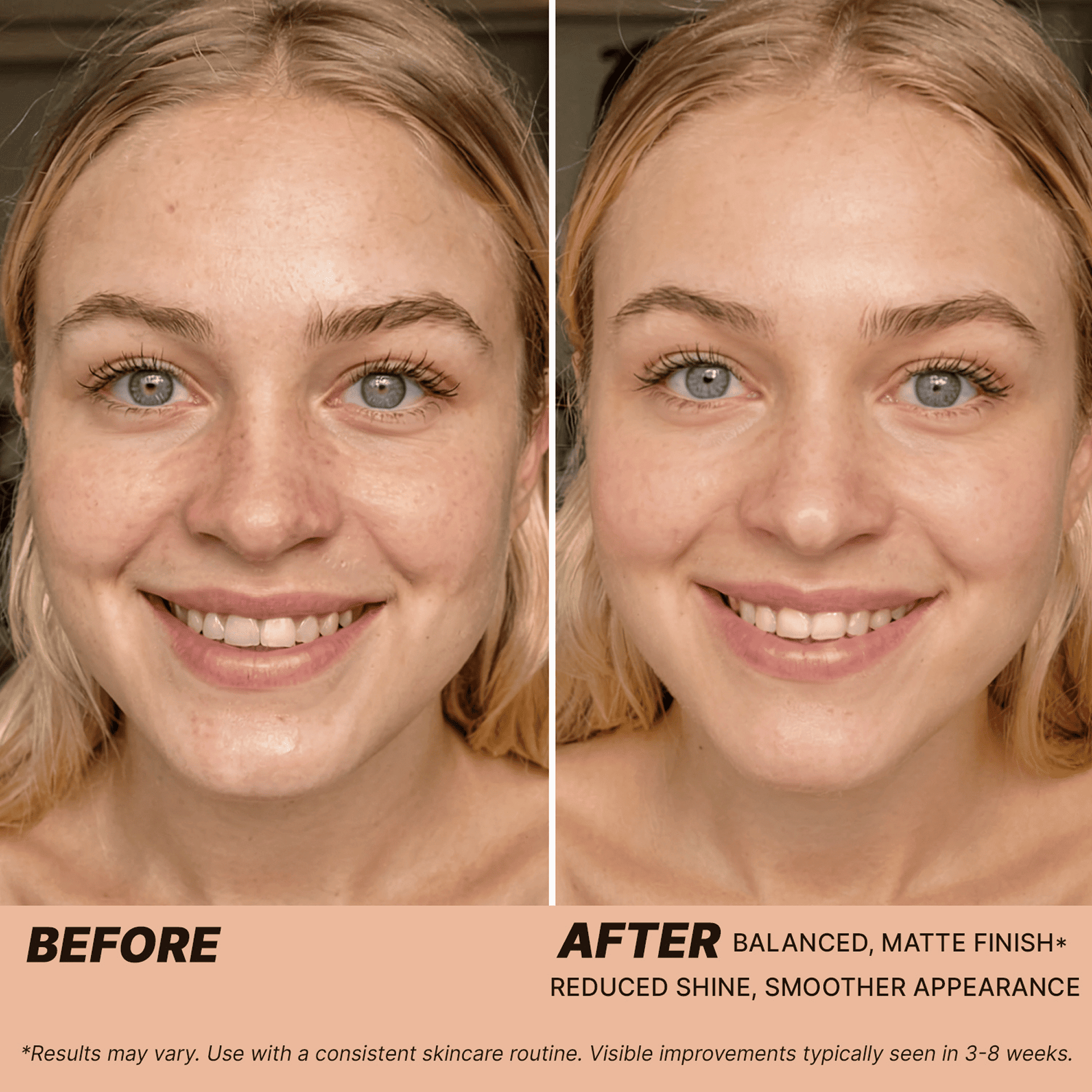 Before and after comparison of a person's face with text indicating skincare results.