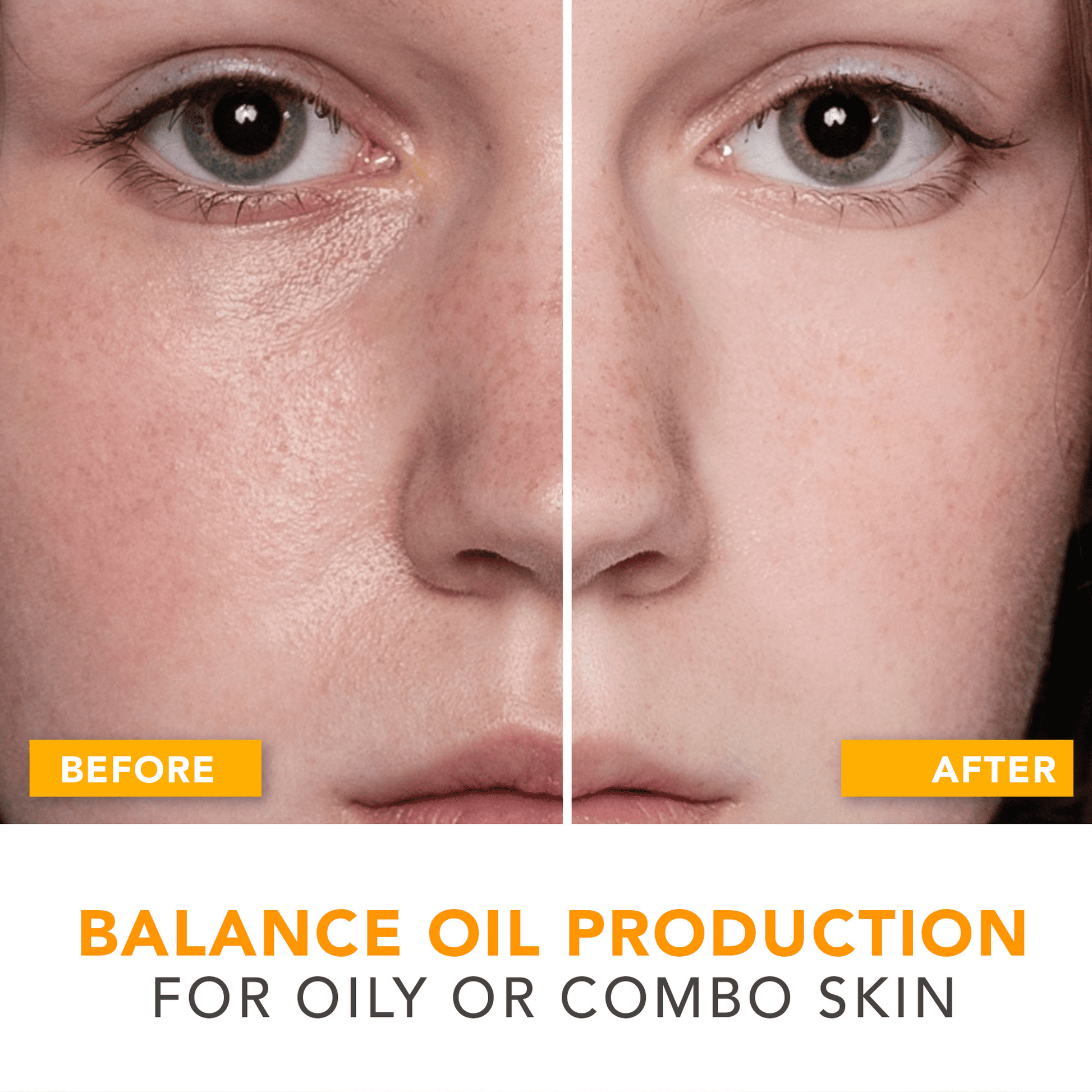 before and after comparison balance oil production for oily or combo skin