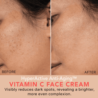Before and after comparison of HyperActive Anti-Aging Vitamin C Face Cream on skin.