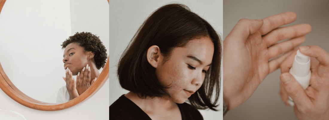 How To Treat Common Skin Concerns With Natural Products
