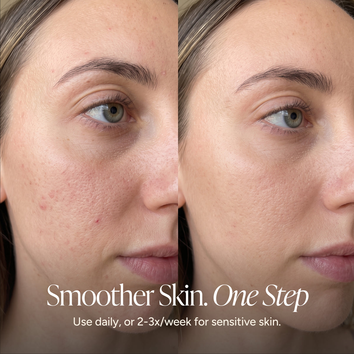 Before-and-after split screen comparison of a woman's face showing smoother skin on the right side, with text at the bottom reading 'Smoother Skin. One Step.