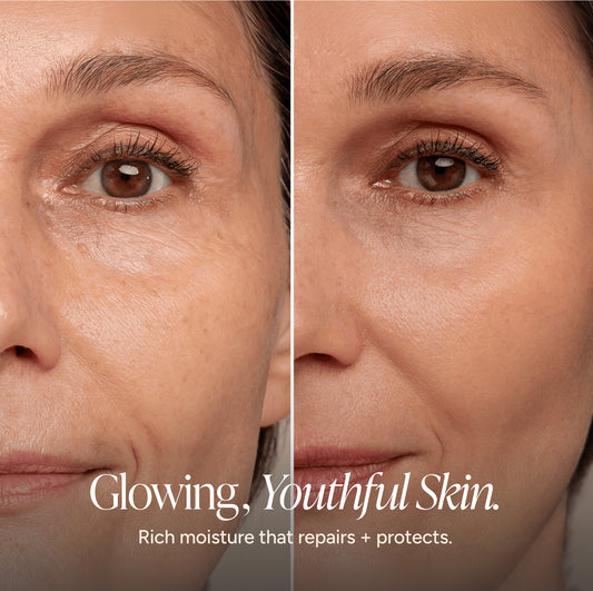 Before-and-after split screen comparison of a woman's face, focusing on the eye area to show skin texture and wrinkles. The left side shows mature, wrinkled skin under the eye, while the right side shows smoother, youthful skin.