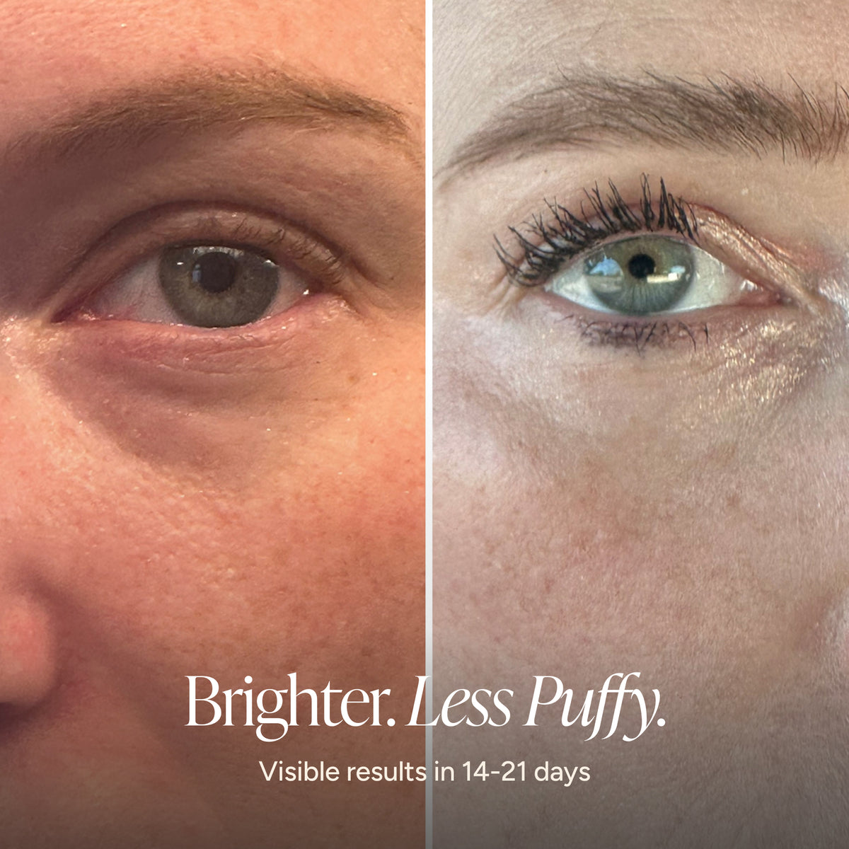 A close-up before-and-after comparison of a person's eye area, showing a puffy, sun-drenched left eye on the left and a brighter, more refreshed right eye on the right. Text at the bottom reads 'Brighter.