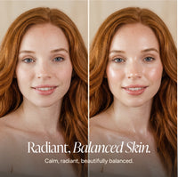 A side-by-side comparison of a woman with red hair showing before-and-after skin results, with the text 'Radiant, Balanced Skin.' and 'Calm, radiant, beautifully balanced.