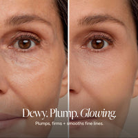 Before-and-after split screen comparison of a woman's eye area, showing wrinkle reduction and smoother skin. Text at the bottom reads 'Dewy.