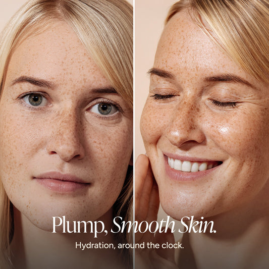 Split-screen close-up of a woman's face showing before-and-after skincare results, with freckles and wrinkles visible on the left and smoother, plumper skin on the right. Text at the bottom reads, 'Plump, Smooth Skin.