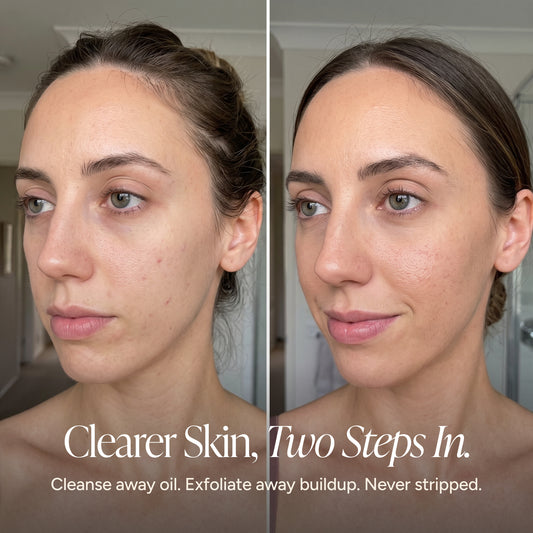 Before-and-after split screen comparison of a woman's face showing clearer skin, with text at the bottom reading 'Clearer Skin, Two Steps In.' and 'Cleanse away oil.