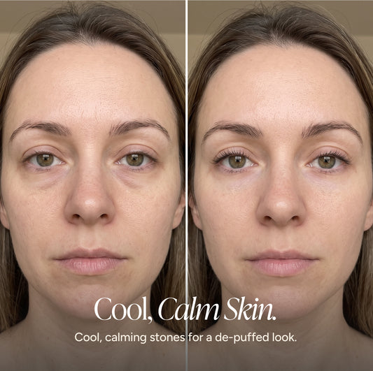 Side-by-side before-and-after comparison of a woman's face showing visibly reduced under-eye puffiness in the after image. Text reads “Cool, Calm Skin” and “Cool, calming stones for a de-puffed look.”