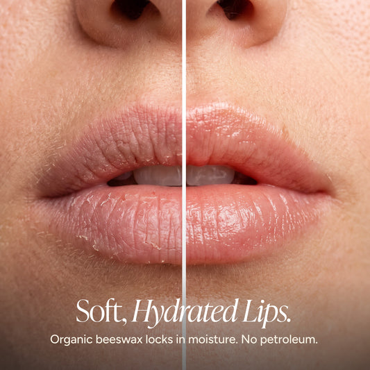 Close-up before-and-after comparison of lips, showing dry, visibly cracked lips on the left and smoother, moisturized lips on the right. Text reads “Soft, Hydrated Lips” and highlights organic beeswax for moisture retention and a petroleum-free formula.