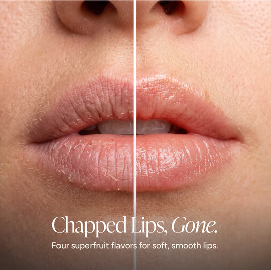Close-up before-and-after comparison of lips, showing dry, chapped lips on the left and smooth, hydrated lips on the right. Text reads “Chapped Lips, Gone” and highlights four superfruit flavors for soft, smooth lips.