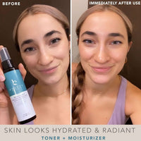 Before and after HA Acid face toner 