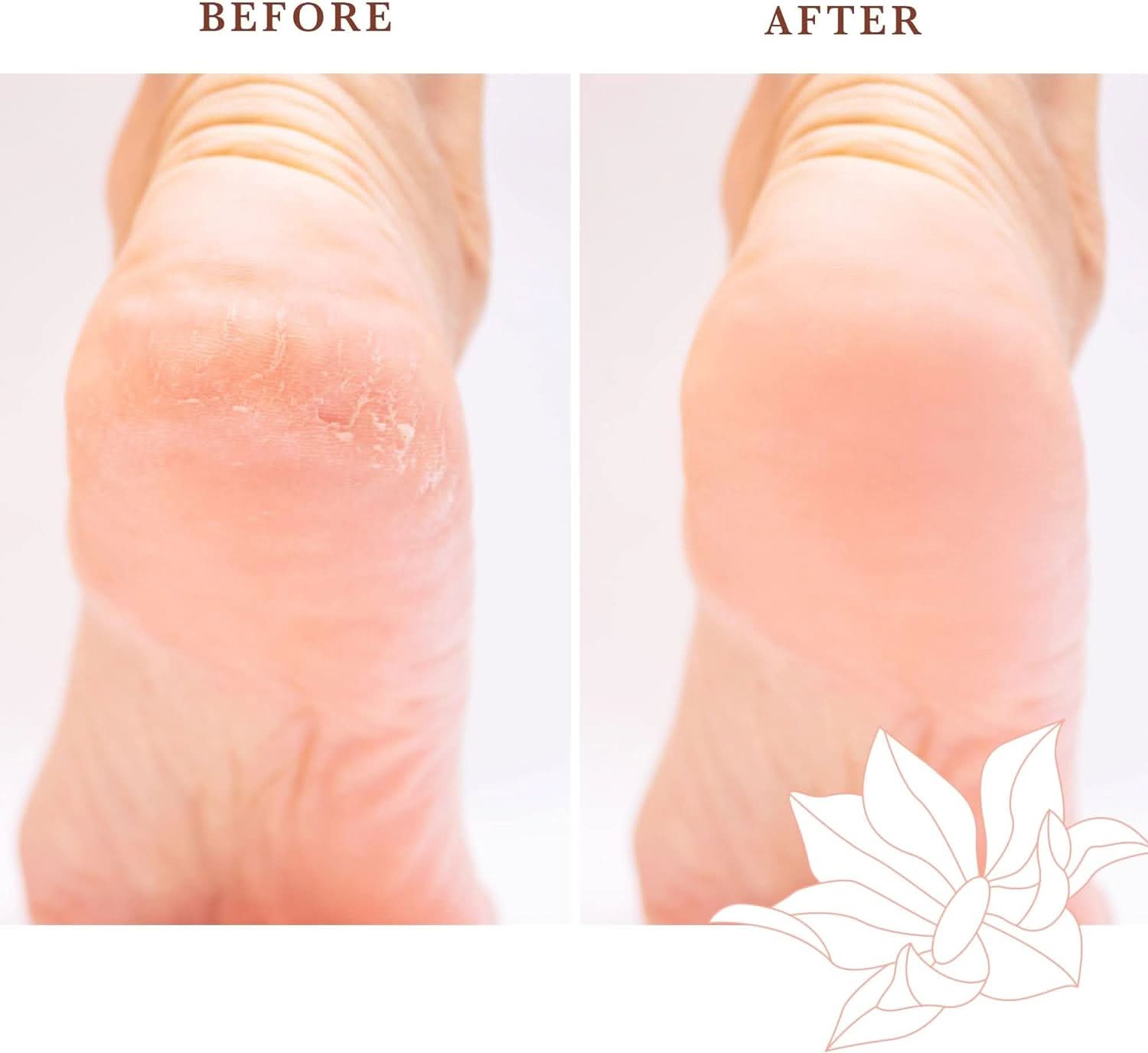 Beauty By Earth - Pumice Stone - Before and After