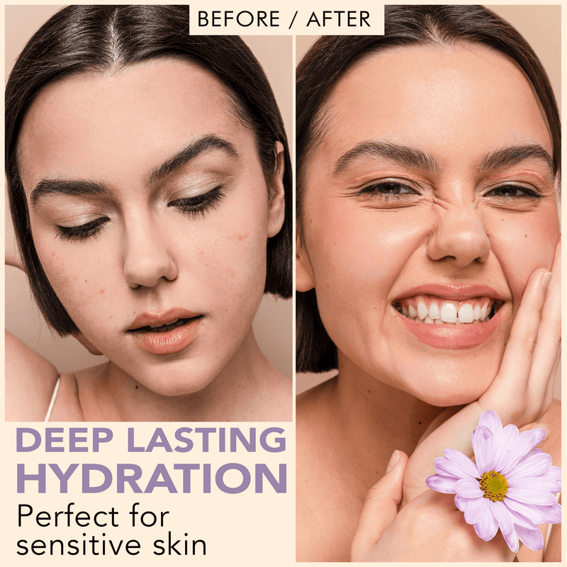 Before and after comparison of a woman's face with deep lasting hydration, perfect for sensitive skin.