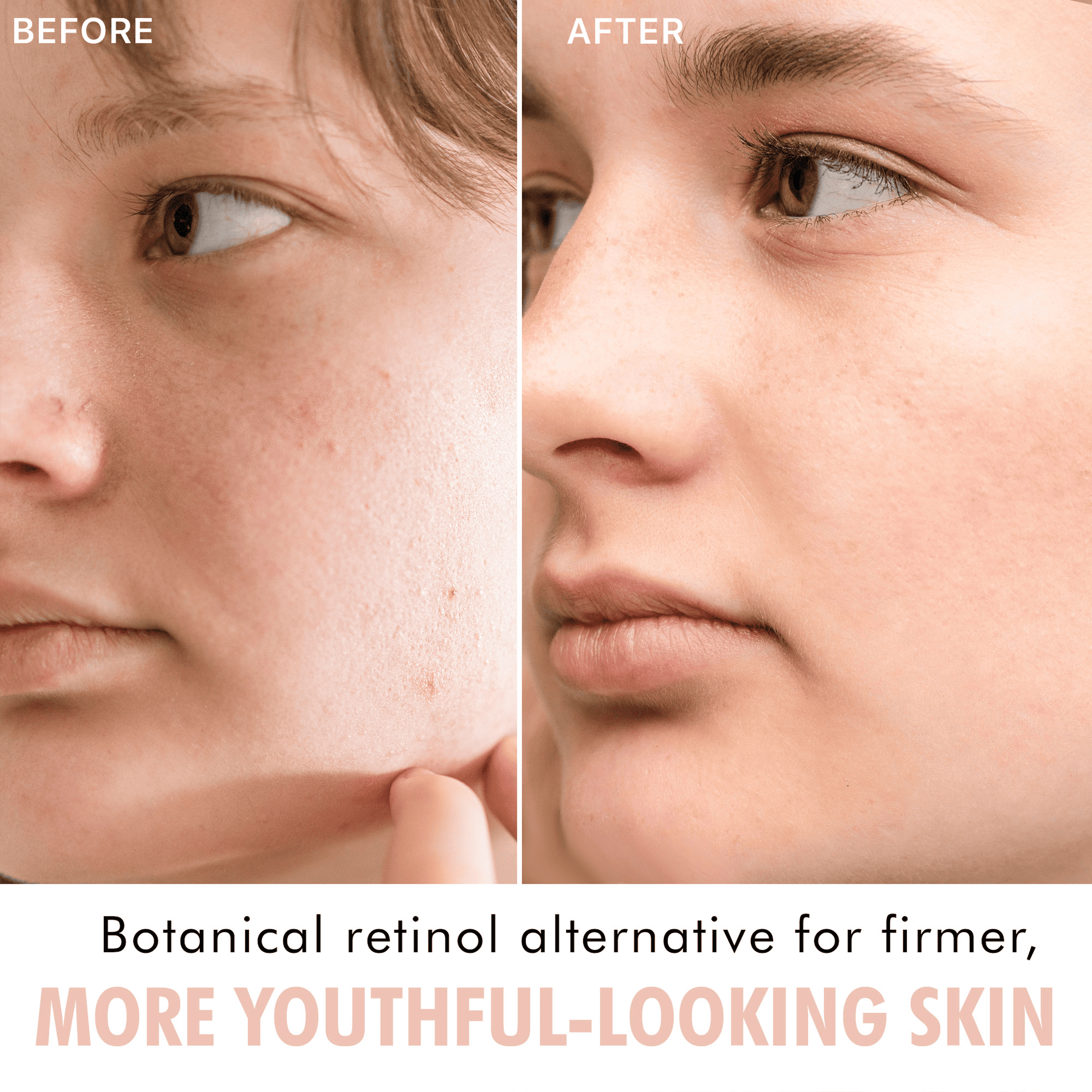 Before and after comparison of a person's face with text about a botanical retinol alternative.