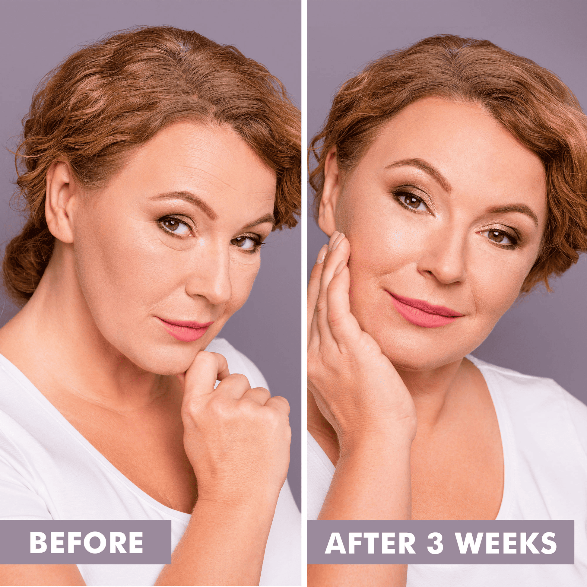 Before and after comparison of a woman's face with text indicating a time frame.