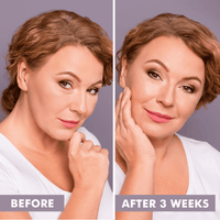 Before and after comparison of a woman's face with text indicating a time frame.