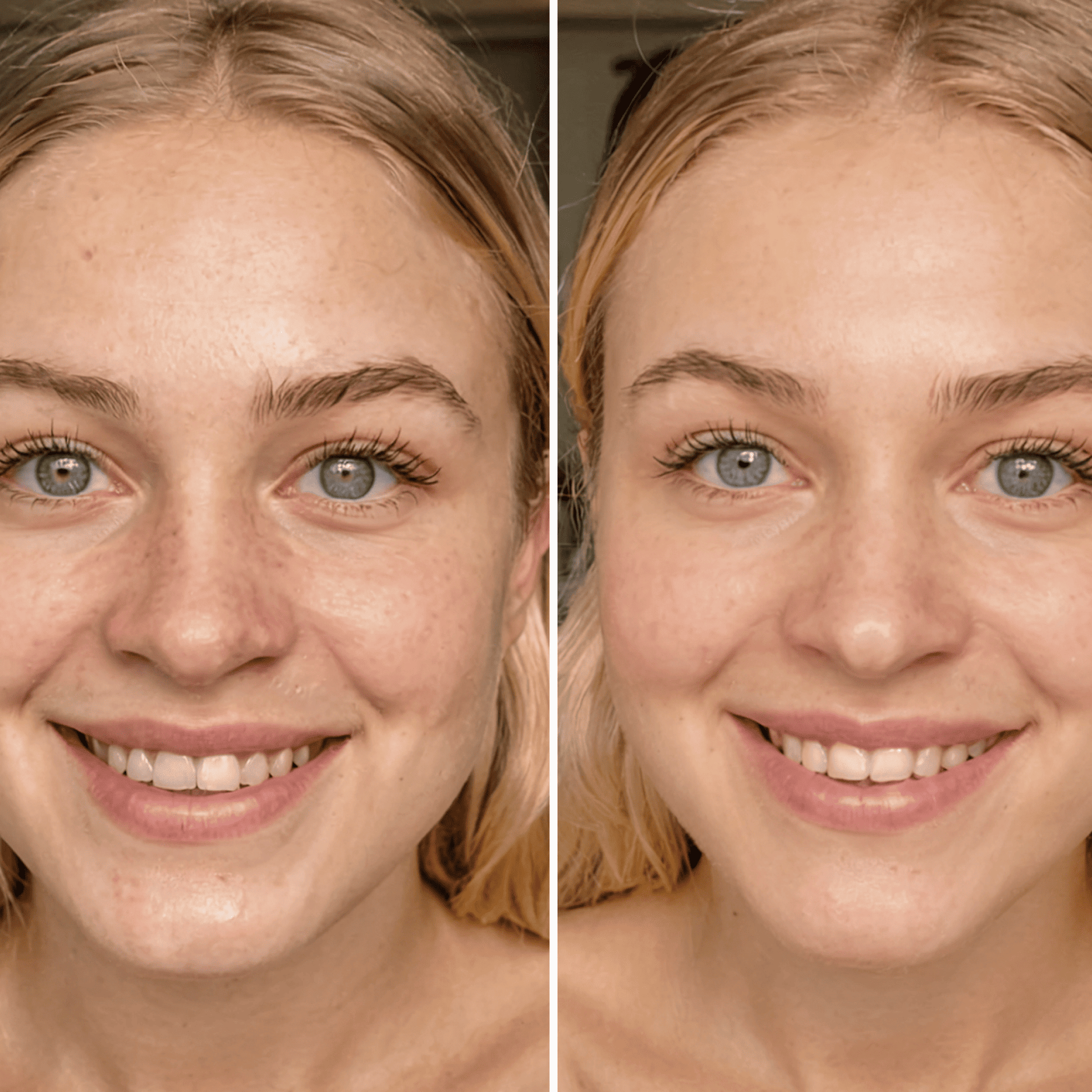 Before and after comparison of a woman's face with visible skin improvement.