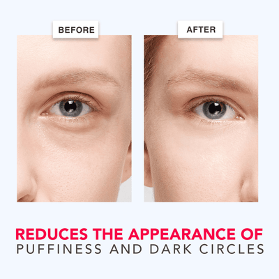 Before and after comparison of eye area with text indicating product's effect on puffiness and dark circles.