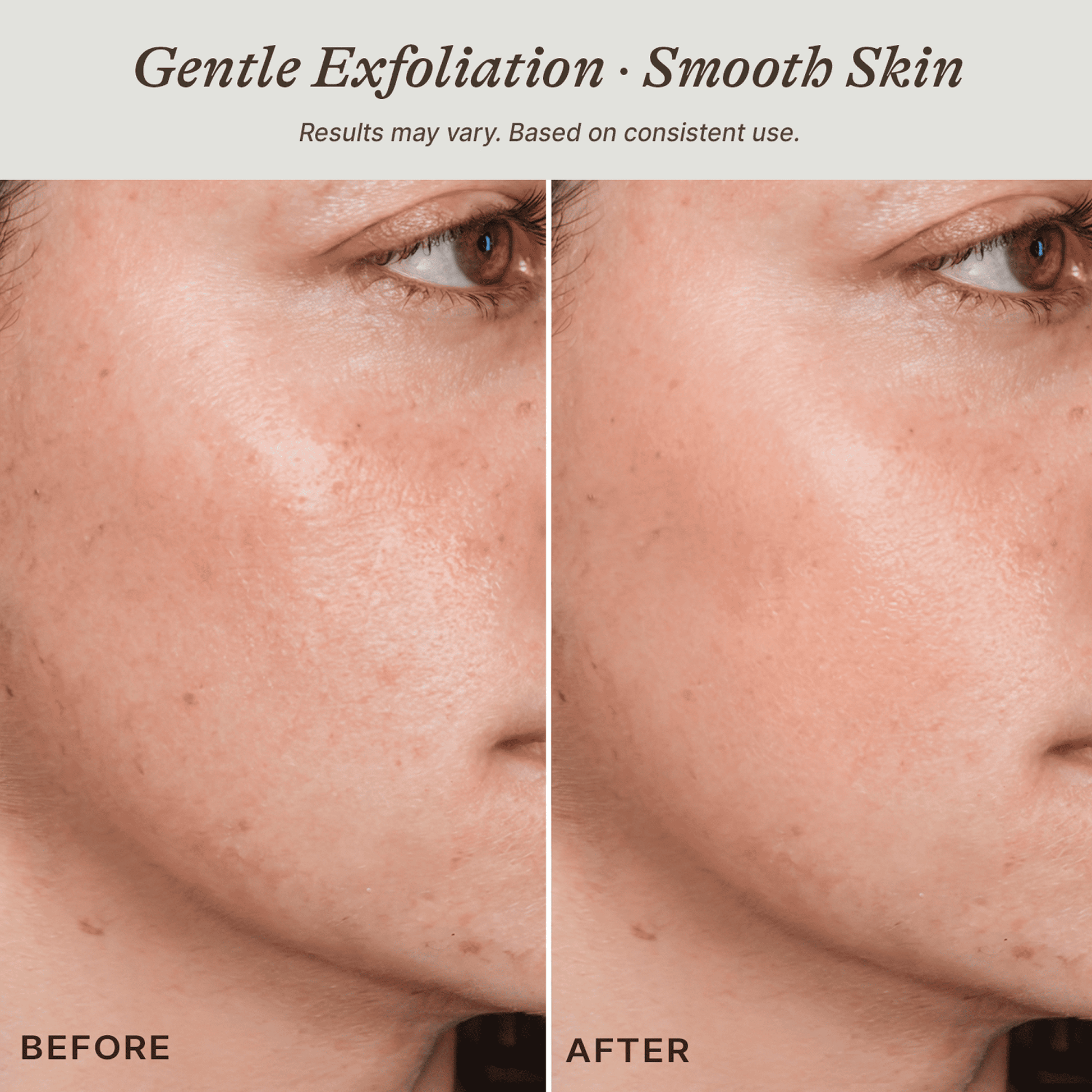 Before and after comparison of skin with gentle exfoliation showing smoother texture.