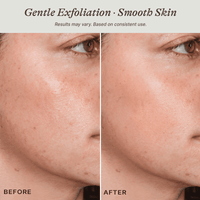 Before and after comparison of skin with gentle exfoliation showing smoother texture.