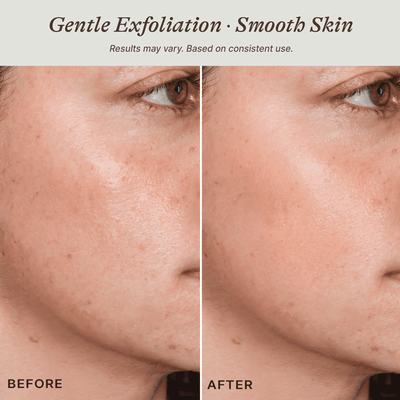 Before and after comparison of skin with gentle exfoliation showing smoother texture.