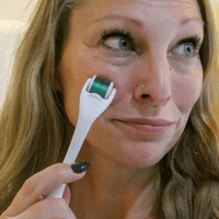 Woman using a derma roller on her face
