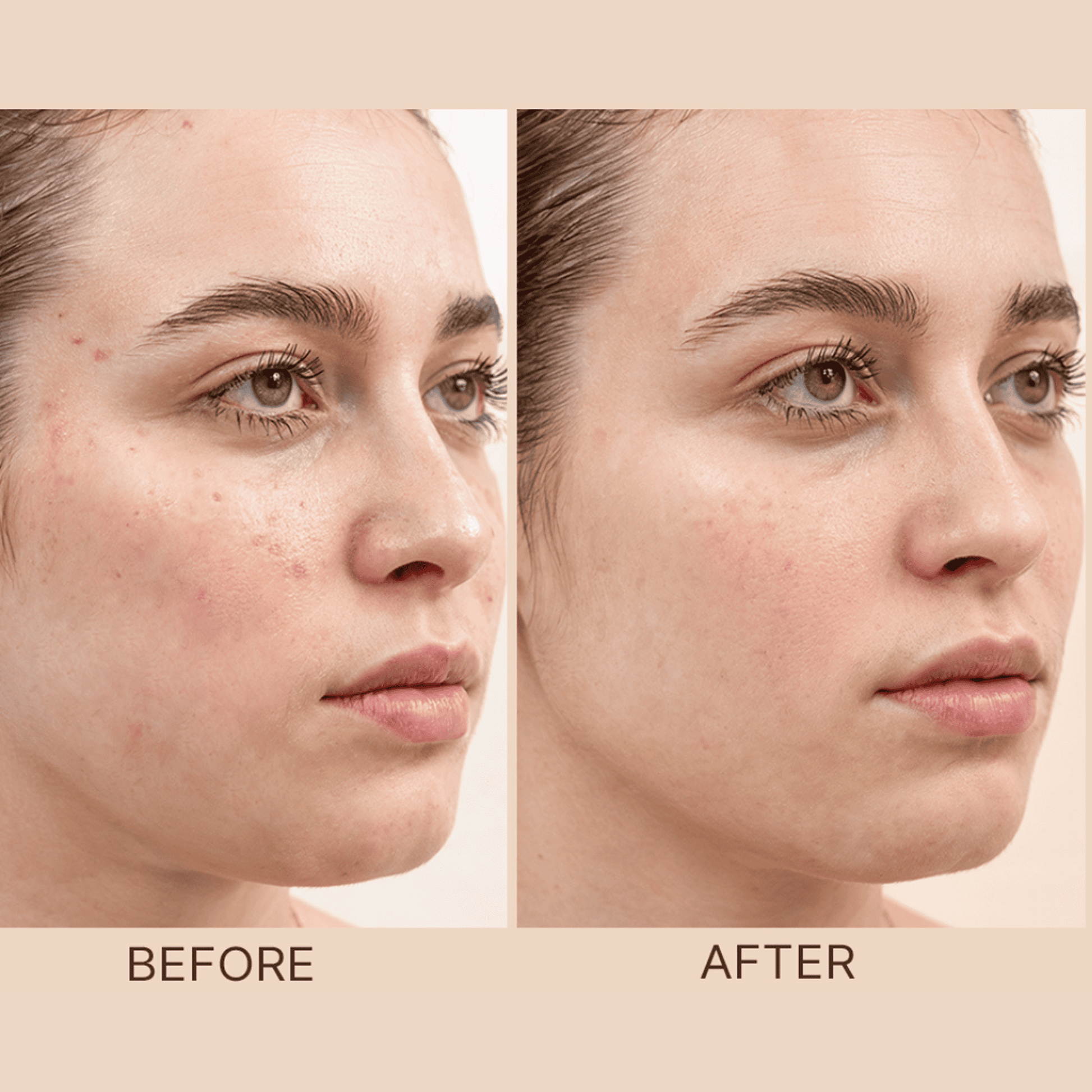 Before and after comparison of a woman's face with visible skin improvement after using clay face mask.