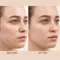 Before and after comparison of a woman's face with visible skin improvement after using clay face mask.