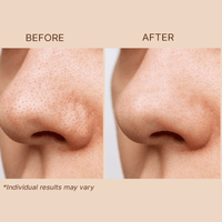 Before and after comparison of a nose with skin treatment after using clay face mask on a beige background