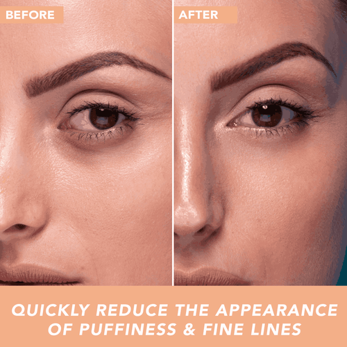 Hyaluronic Acid Eye Gel