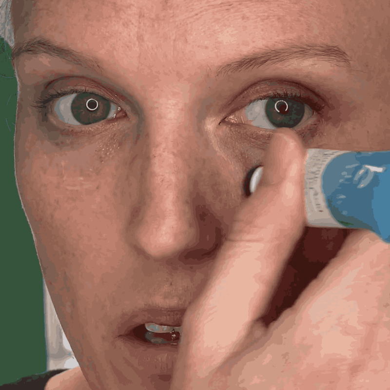 Person applying eye gel with a close-up of the eye area.