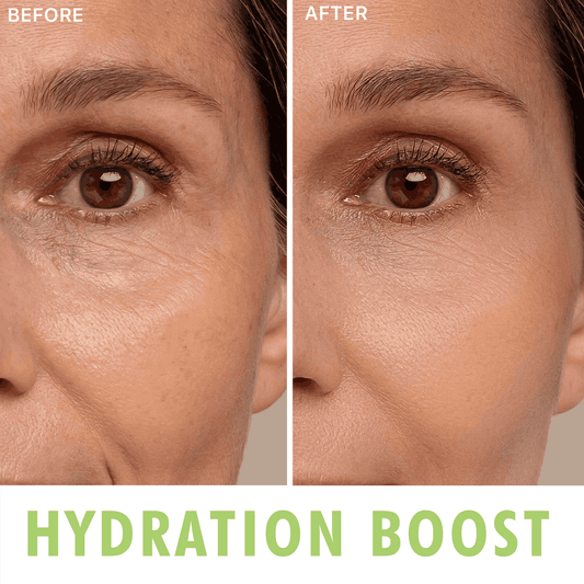 hydration boost