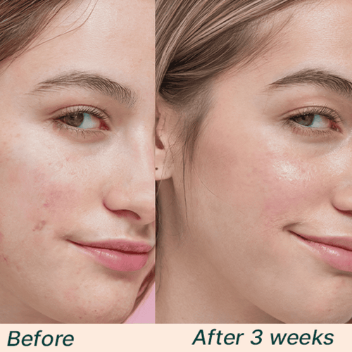 Hyaluronic Acid Trio Bundle