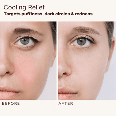 Before and after comparison of a woman's face with text about cooling relief for puffiness, dark circles, and redness.