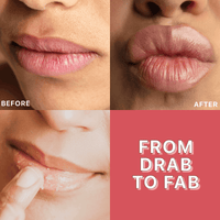 Before and after comparison of lips with text 'From Drab to Fab' on a red background.