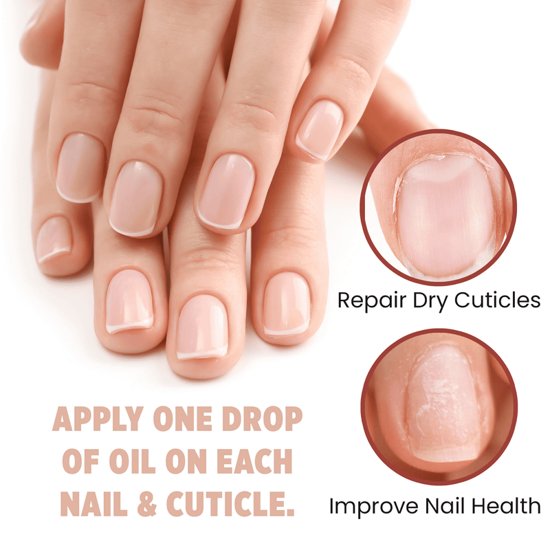 Hand with manicured nails and cuticles, showing before and after effects of nail care product application.