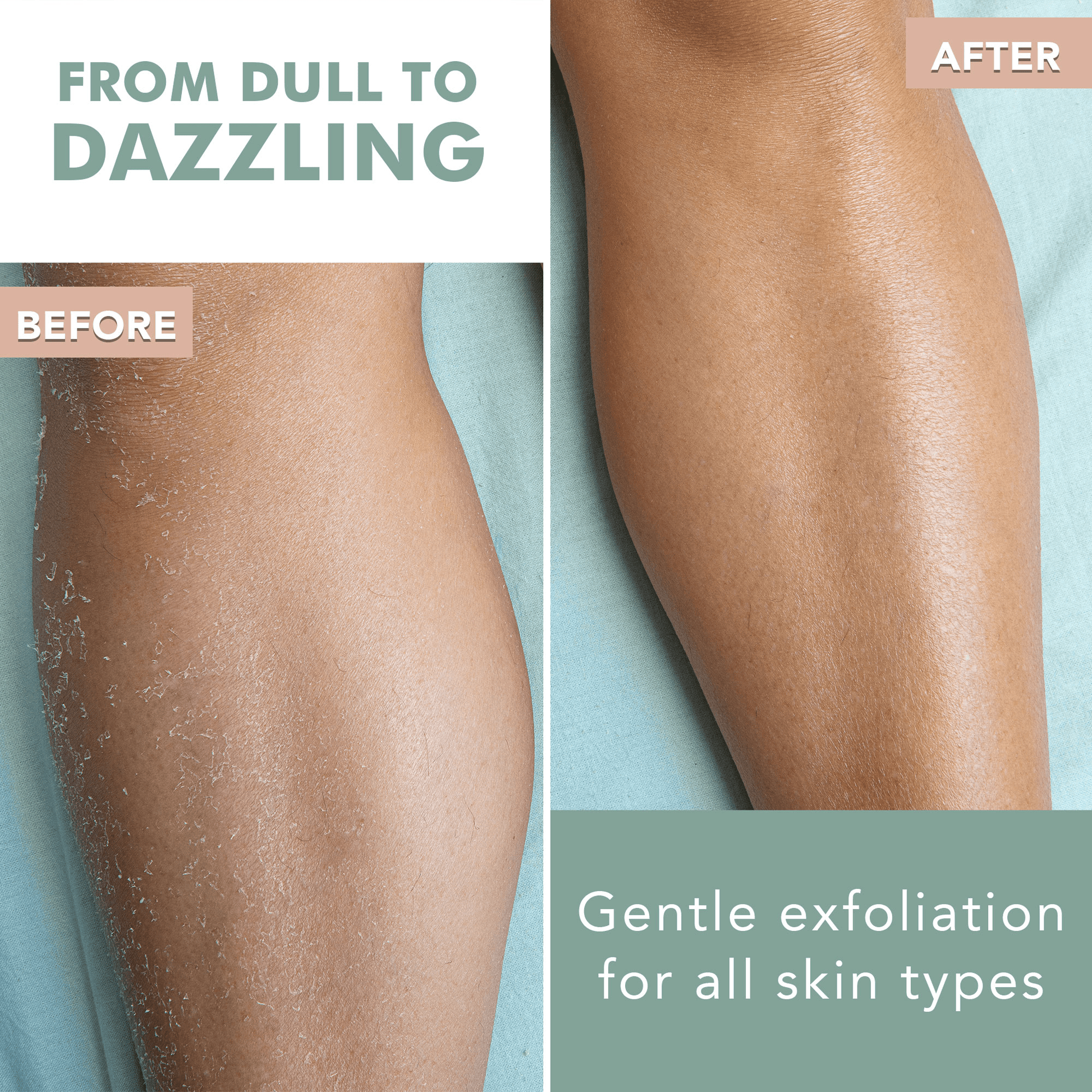 exfoliation before after