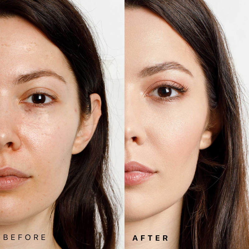 Before and after comparison of a woman's face with visible skin improvement.