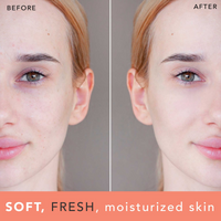 Before and after comparison of a woman's face with text 'SOFT, FRESH, moisturized skin'.