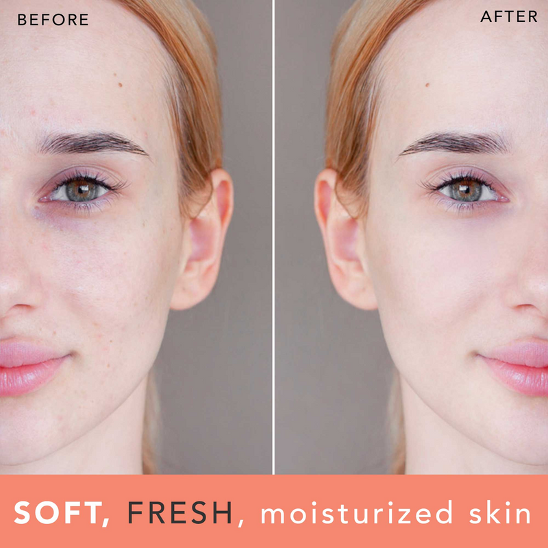 Before and after comparison of a woman's face with text 'SOFT, FRESH, moisturized skin'.