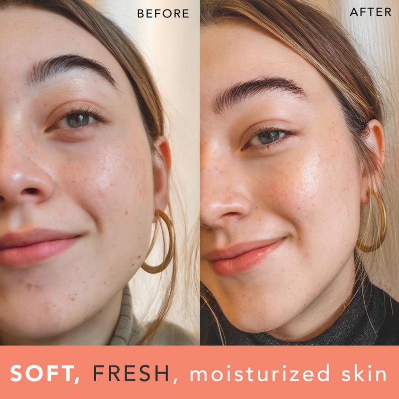 Before and after comparison of a person's face with text 'SOFT, FRESH, moisturized skin'.