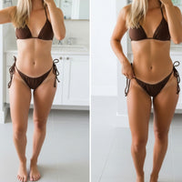 Before - After