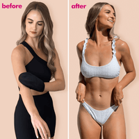 Before and after comparison of a woman wearing a black arm sleeve and a blue bikini.