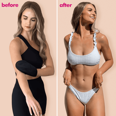 Before and after comparison of a woman wearing a black arm sleeve and a blue bikini.