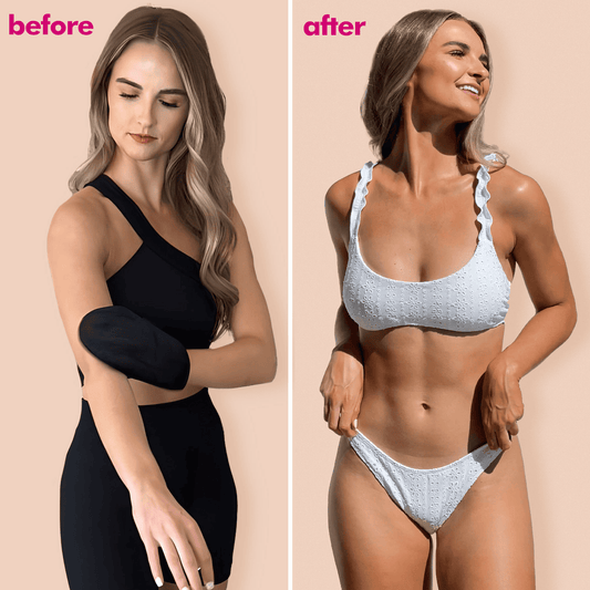 Before and after comparison of a woman wearing a black arm sleeve and a blue bikini.