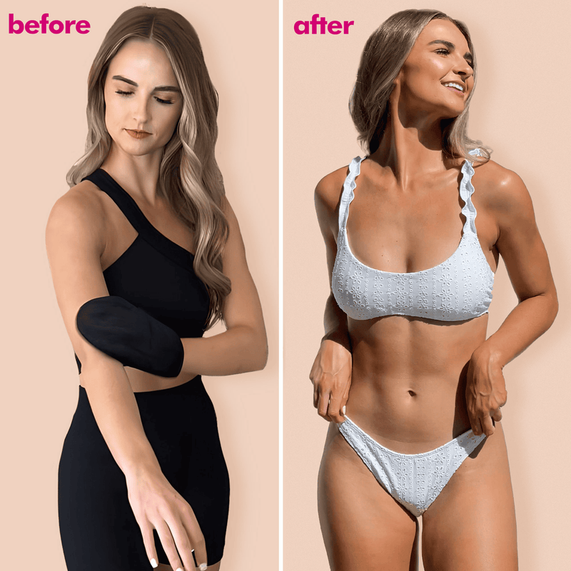 Before and after comparison of a woman wearing a black arm sleeve and a blue bikini.