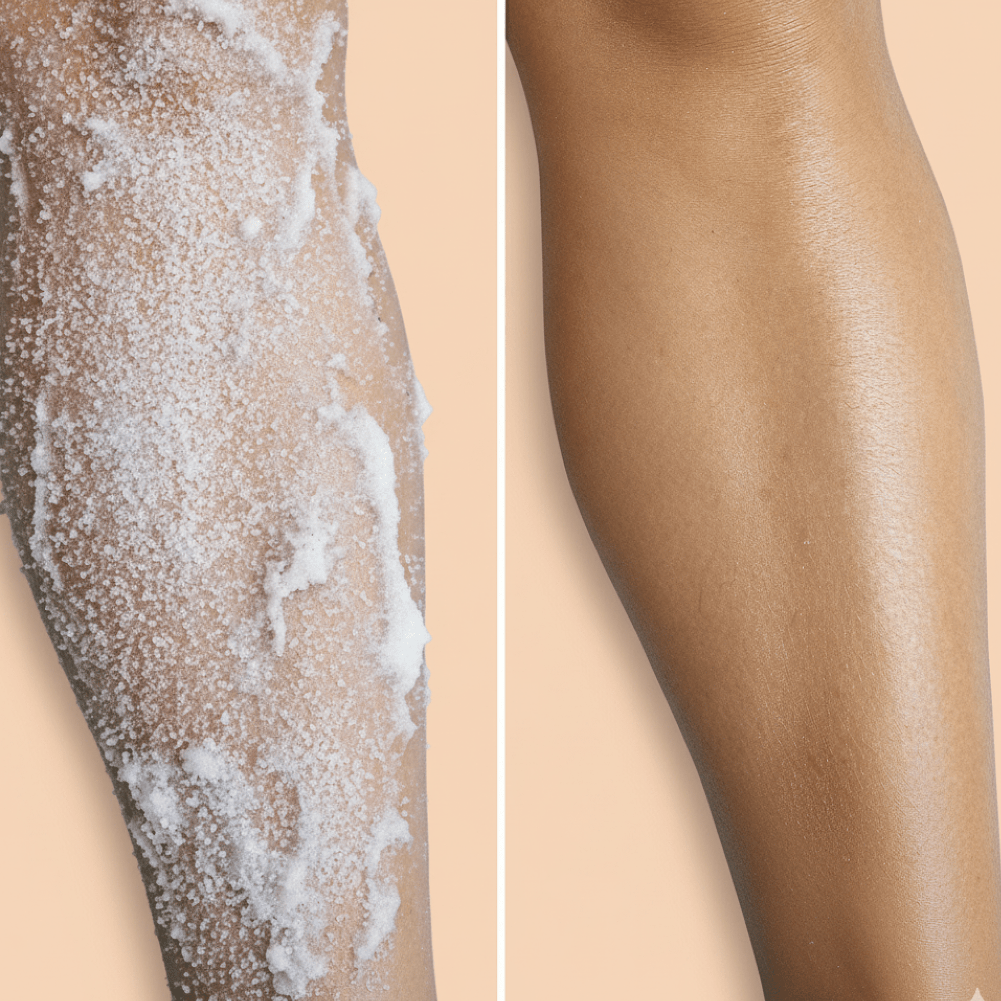 Comparison of legs with and without hair removal using a hair removal product.