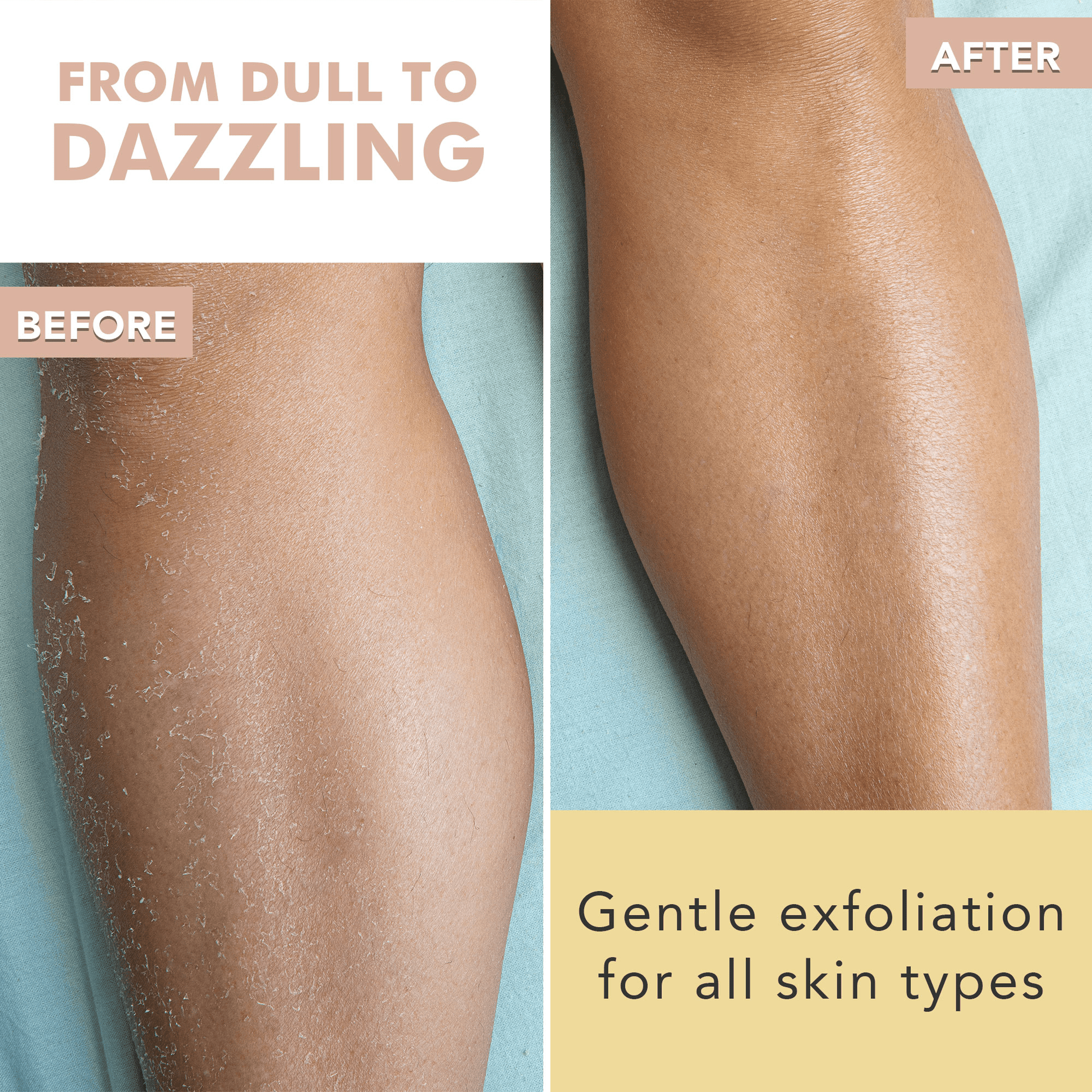 Before and after comparison of a person's leg with exfoliation product, showing smooth skin.