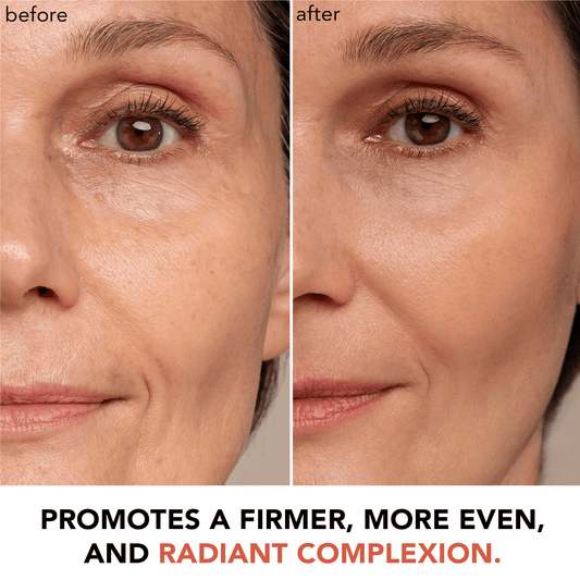 Before and after comparison of a woman's face with text promoting skin improvement.